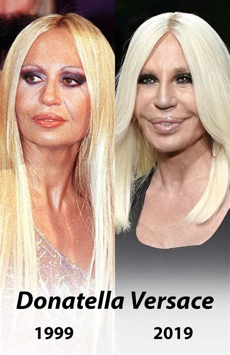 donatella versace früher vs heute|Donatella Versace: Ihr Aussehen früher und heute.